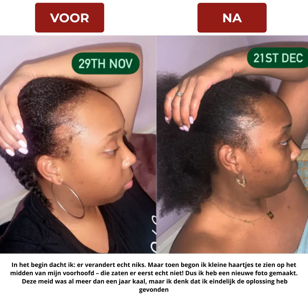 Samirahair Batana Oil Haargroeiversneller