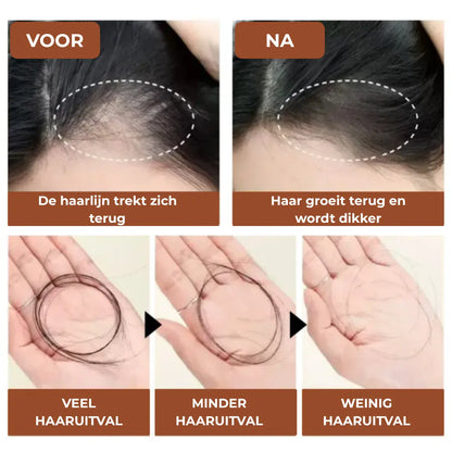 Samirahair Batana Oil Haargroeiversneller