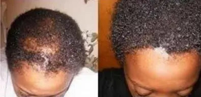 Samirahair Batana Oil Haargroeiversneller